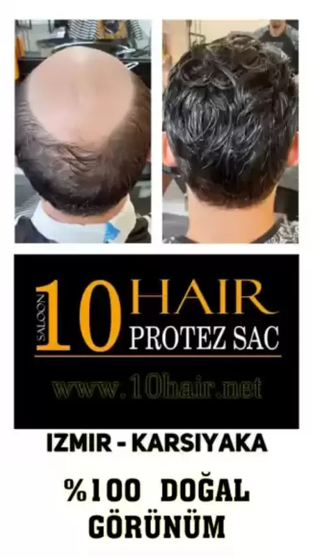 10 Hair Protez Saç 